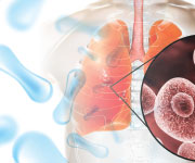 computer illustration of lung cells